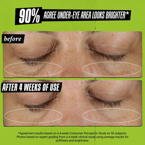 V2H34AC1FB8A2CF9E56DE6C7F92AC7FDA1DR7659704P6